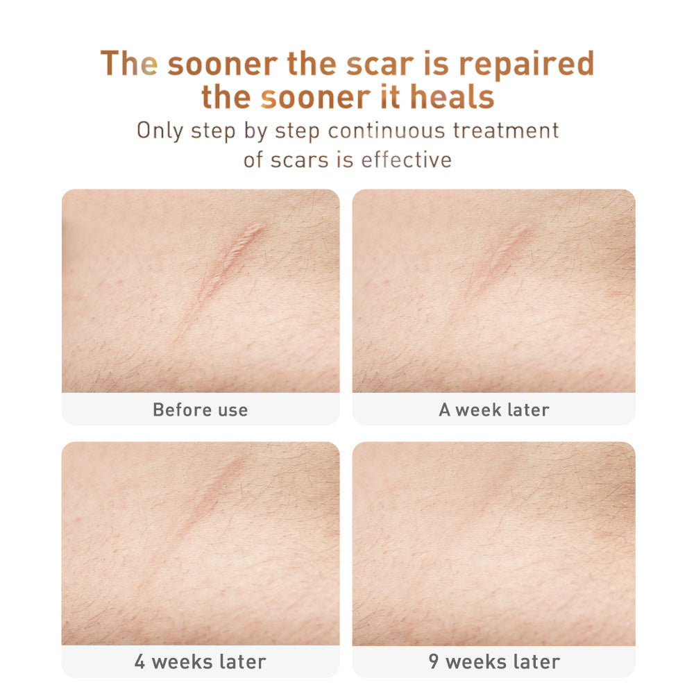 Traditional Chinese Medicine Scar Removal Cream Care Cream Skin Care Products Traditional Chinese Medicine Scar Removal Cream Care Cream Skin Care Products